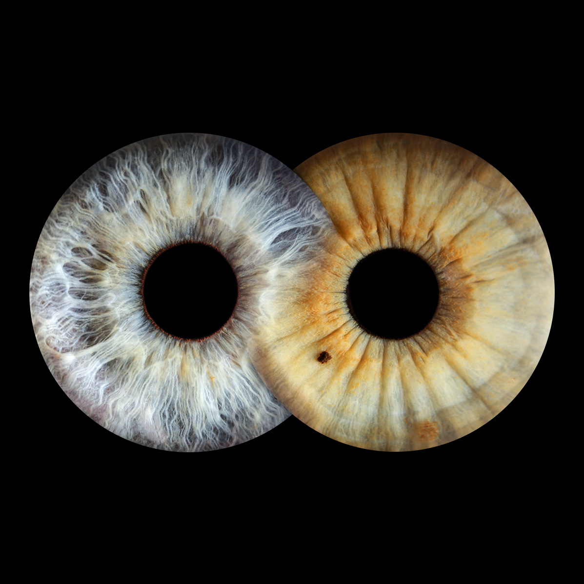 Парное фото радужки глаза