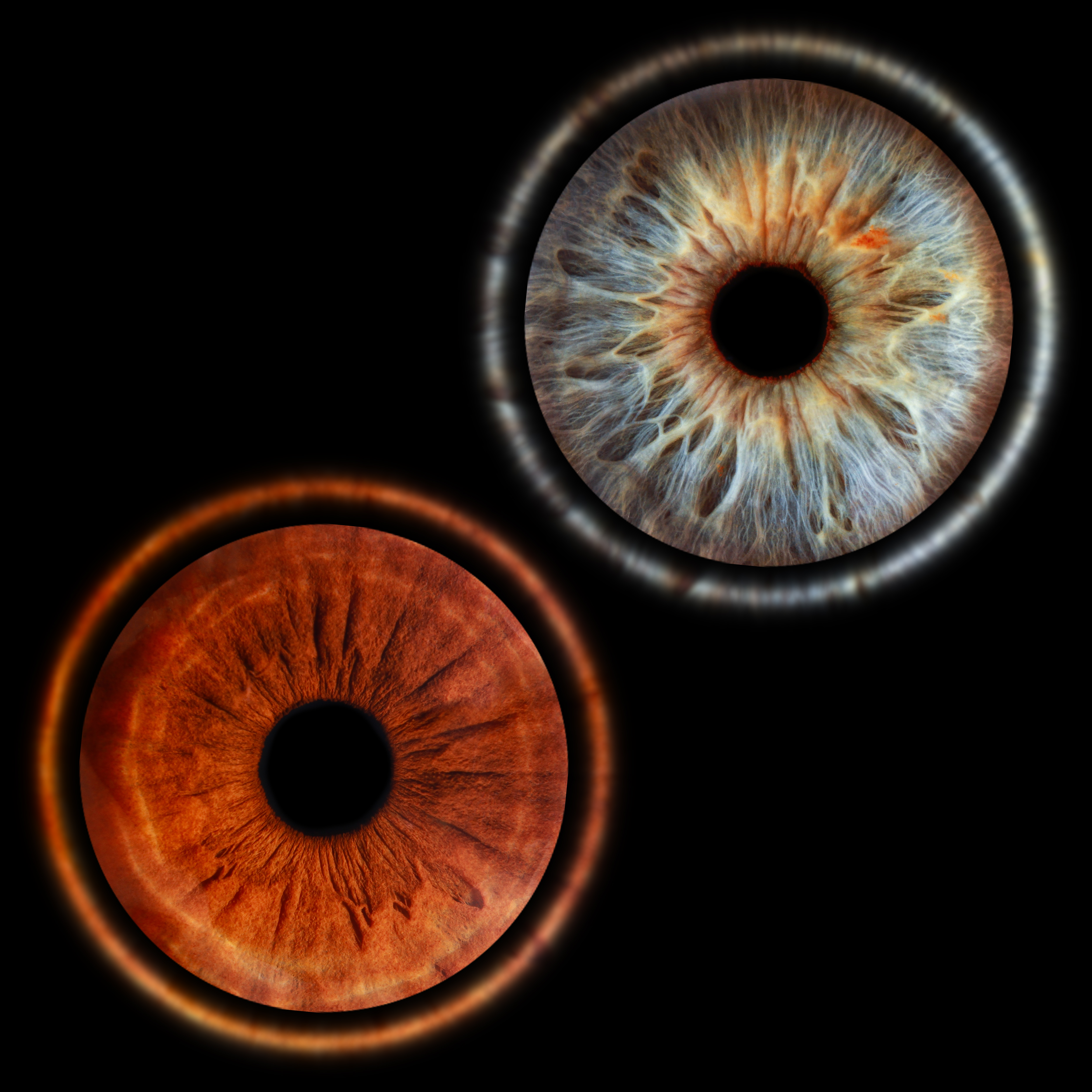 Парное фото радужки глаза